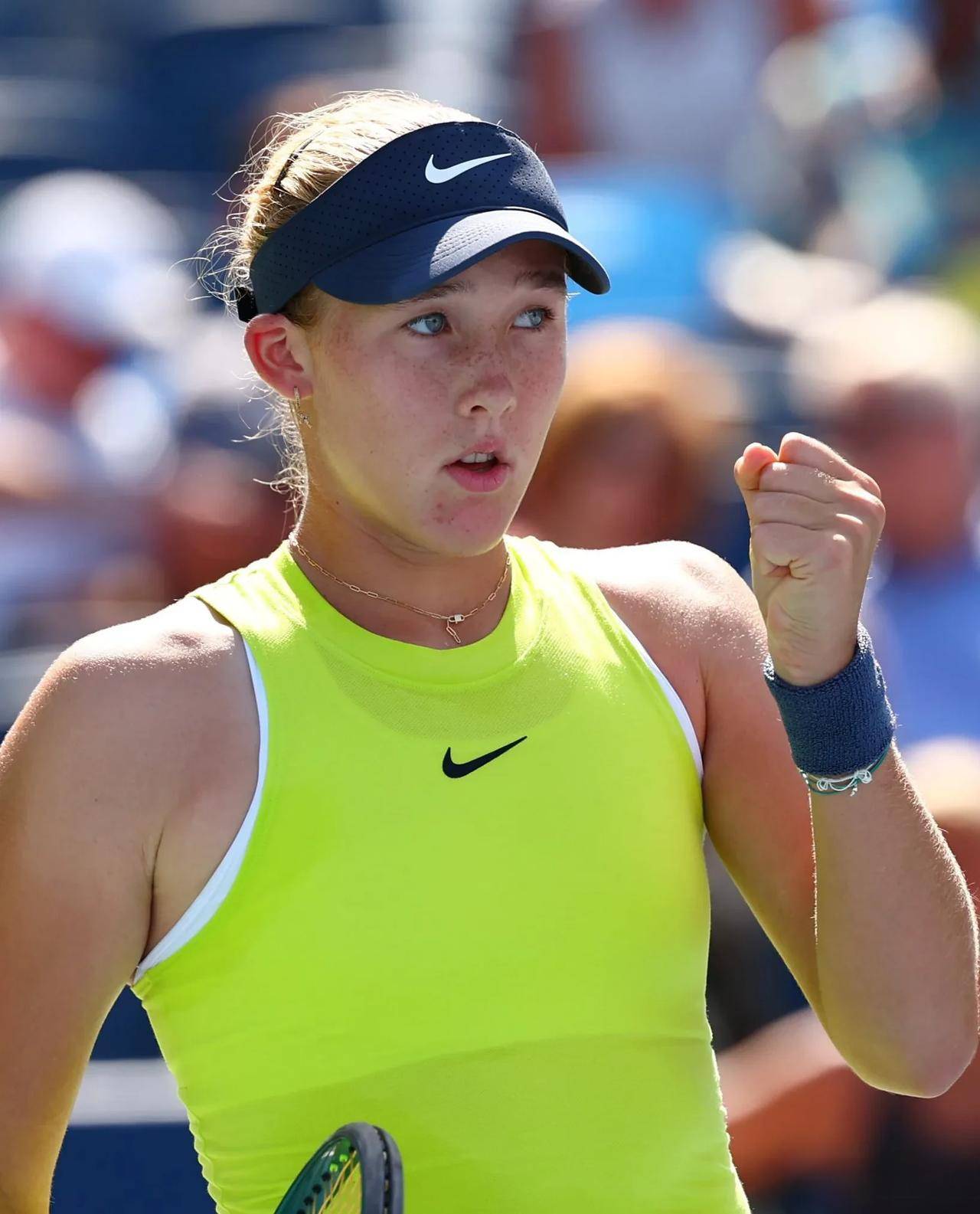 松击败魔术 松击败魔术